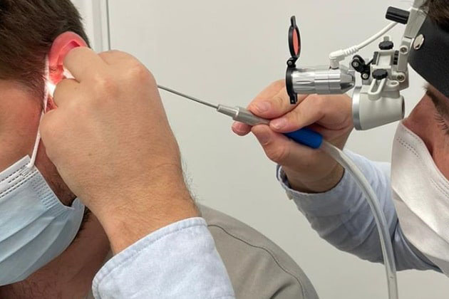 ear-wax-removal
